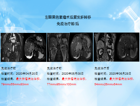 博鳌国际医院创造生命奇迹，晚期恶性黑色素瘤患者送旗感恩插图8